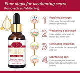 Aichun Beauty Remove Scars Facial Serum - AC31954