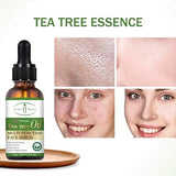 Aichun Beauty #AC31984 Tea Tree Oil Face Serum 30ml