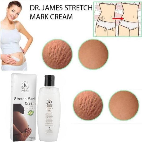 Dr.James Stretch Mark Cream 200ml