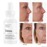 The Ordinary Hyaluronic Acid 2% + B5 Facial Serum